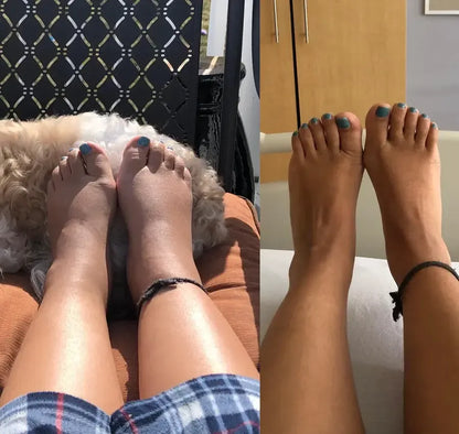Neuropathy Socks for Women and Men for Relief Swollen Feet and Ankles